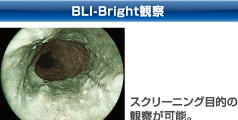 BLI-Bright観察